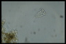 Vorticella