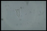 Vorticella