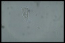 Vorticella