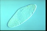 Paramecium caudatum, intact cells