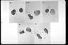 Paramecium caudatum, micronuclei during conjugation