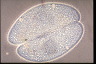 Paramecium caudatum, micronuclei during conjugation