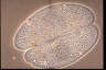 Paramecium caudatum, micronuclei during conjugation