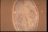 Paramecium caudatum, micronuclei during conjugation