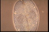 Paramecium caudatum, micronuclei during conjugation