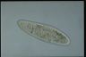 Paramecium multimicronucleatum