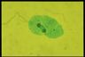 Paramecium caudatum, macronuclear inclusion body