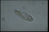 Paramecium polycaryum