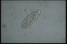 Paramecium polycaryum