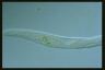 Spirostomum teres