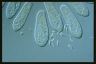 Paramecium caudatum