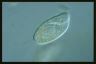 Paramecium trichium