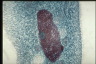 Paramecium caudatum, macronuclear inclusion body