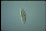 Paramecium caudatum, macronuclear inclusion body