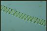 Spirogyra