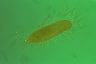 Paramecium caudatum, Trichocysts