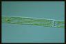 Spirogyra