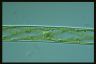 Spirogyra