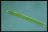 Spirogyra