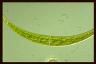 Closterium ralfsii