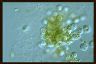 Lecythium