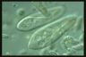 Paramecium caudatum, food vacuole