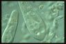 Paramecium caudatum, food vacuole