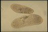 Paramecium jenningsi