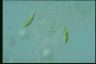 Euglena gracilis