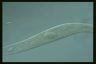 Spirostomum teres