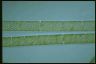 Spirogyra