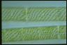 Spirogyra