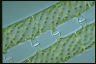 Spirogyra