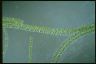 Spirogyra