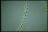 Spirogyra