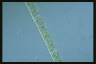 Spirogyra