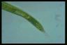 Euglena oxyuris