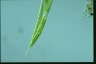 Euglena oxyuris