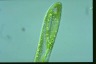 Euglena oxyuris