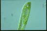 Euglena oxyuris