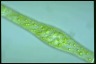 Spirogyra