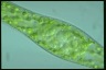 Spirogyra