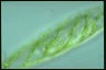 Spirogyra