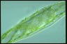 Spirogyra