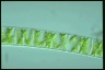 Spirogyra