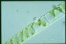 Spirogyra Rhizophydium