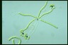 Ophiocytium arbuscula