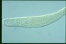 Spirostomum