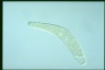 Spirostomum