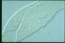 Spirostomum